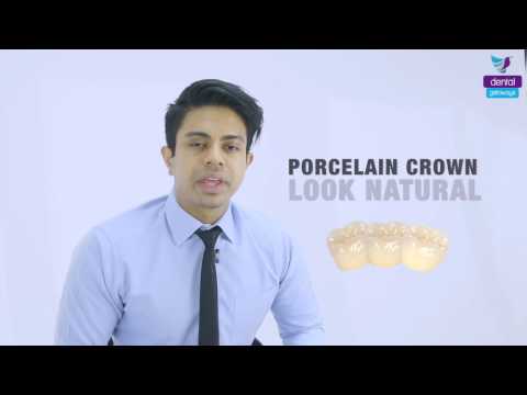 DENTAL GETAWAYS - Dental Crowns