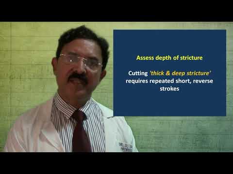 Cutting of Urethral Stricture - Technical Variations 1