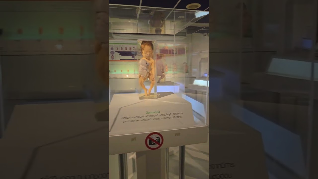 YouTube Short thumbnail