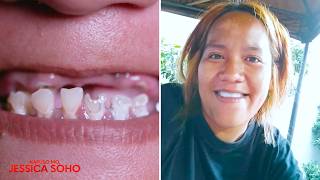 Ngipin, nabulok dahil sa bagsak-presyong DIY veneers?! | Kapuso Mo, Jessica Soho