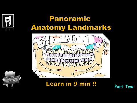 Panoramic Radiography landmark/Orthopantomogram(OPG)Anatomical Landmark/Dental Exam/Dental Radiology