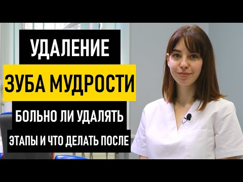 Удаление зуба мудрости на нижней и верхней челюсти. Больно ли удалять зуб мудрости снизу и сверху