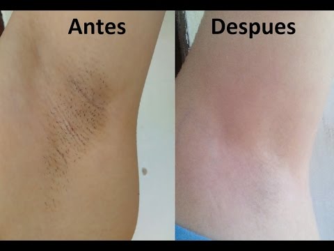 Pigmentazione della pelle dopo privazione La decolorazione di creme con risposte aliexpress