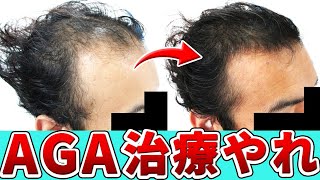 【ミノキシジルは効く？】AGA治療の効果と副作用を発毛のプロが徹底解説！