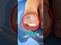 Stop Cutting Your Toenails Like This… It’s Causing Pain 😱