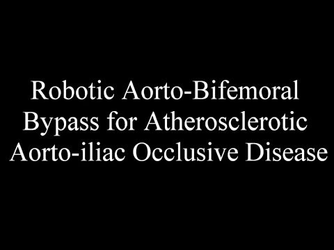 Cirugía aórtica robótica - derivación aorto-bifemoral para la enfermedad oclusiva aorto-ilíaca aterosclerótica (síndrome de Leriche)