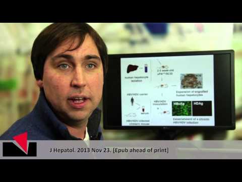 Videoabstract english "Persistent Hepatitis D Virus mono-infection ..."