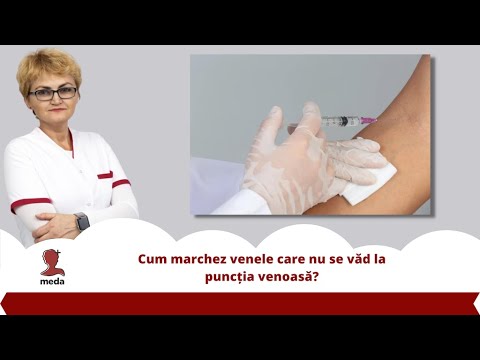 cum sa avertizai varicoza pe picioarele voastre diagrama tratamentului cu medicamente cu varicoza