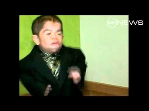 World's Shortest Man