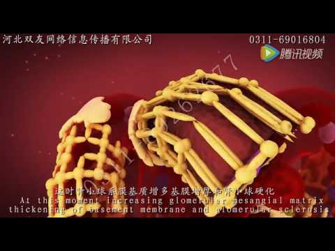 Diabetic nephropathy