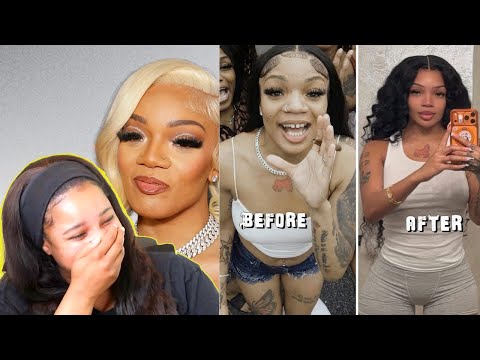 The TERRIFYING Truth About GloRilla's Plastic Surgery | Reaction