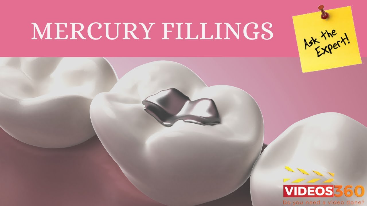 Why should silver mercury fillings (amalgams) be removed