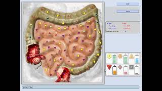 Bioplasm  installing & Operating Video