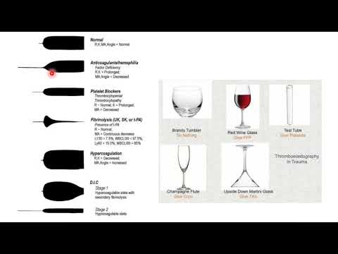 #thromboelastogram interpretation, #TEG interpretation, #How to interpreted TEG, ICU