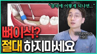 환자와 치과의사가 만족하는 내비게이션 임플란트, 이게 그렇게 좋은 거야?! [치과전문채널 365Tube]