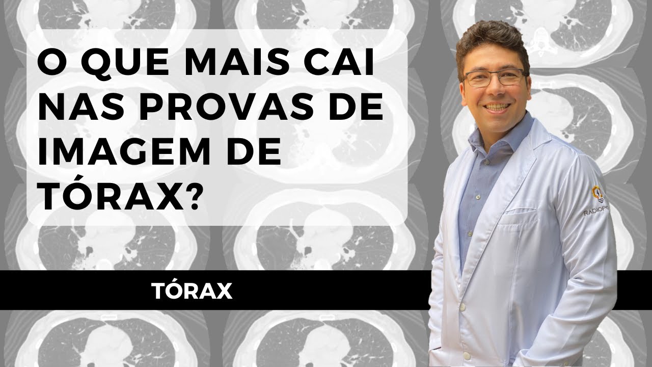 PRINCIPAIS PATOLOGIAS DO TÓRAX