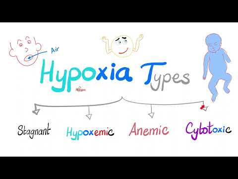 Types of Hypoxia (Stagnant, Hypoxemic, Anemic & Cytotoxic) - Pathophysiology