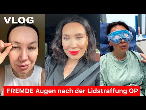 VLOG: MEINE AUGEN NACH DER LIDSTRAFFUNG OP | VORHER & NACHHER | VERLOSUNG