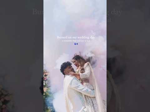 Bride BURNT on wedding day | Evil Eyes 🧿 #wedding #bride #accident #viralvideo #viralshorts #insta