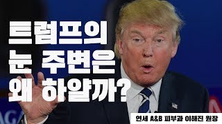 [기획취재] 트럼프의 눈 주변은 왜 하얄까?!