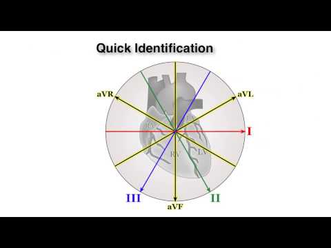 ECG Basics 6/10 - Calculating the Axis