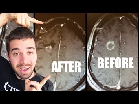 AMAZING NEWS!!! (12.16.13 - Day 1691)