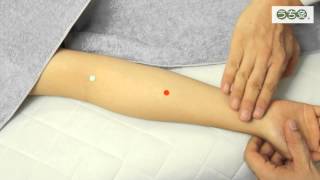 郄門（げきもん）ツボ解説