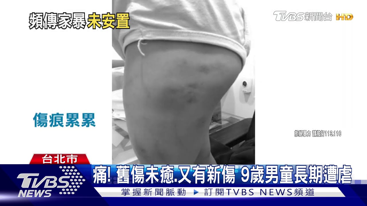 傷不致命!男童2年家暴11次 社局未安置