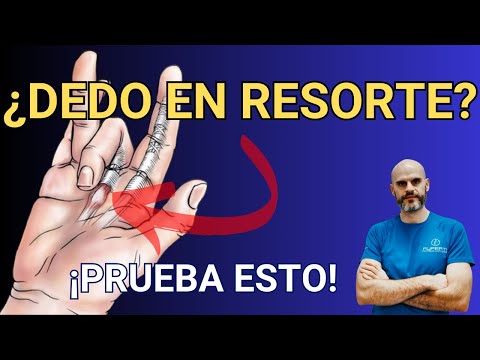 Trigger Finger Relief: Techniques and Exercises to Treat Trigger Finger