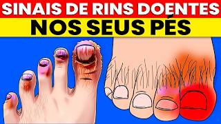 9 Sinais em SEUS PÉS que INDICAM INSUFICIÊNCIA RENAL (doença dos rins)