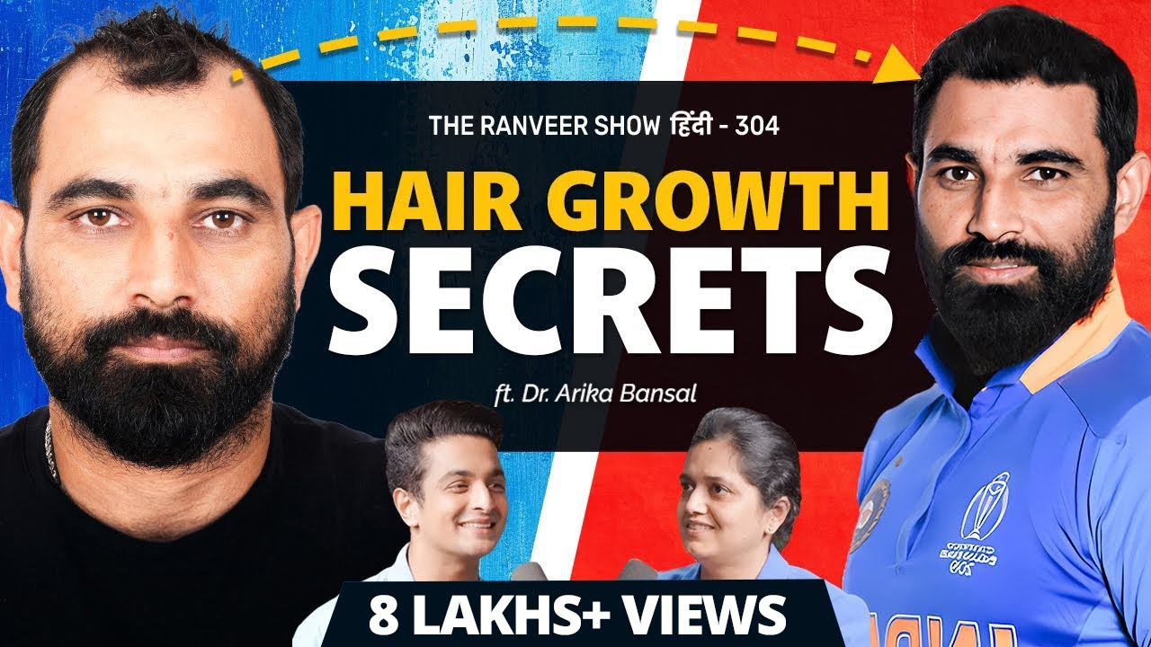 Hair Loss Treatment & Hair Growth | Dr. Arika B On Hairfall, Baldness & Transplant | TRS हिंदी 304