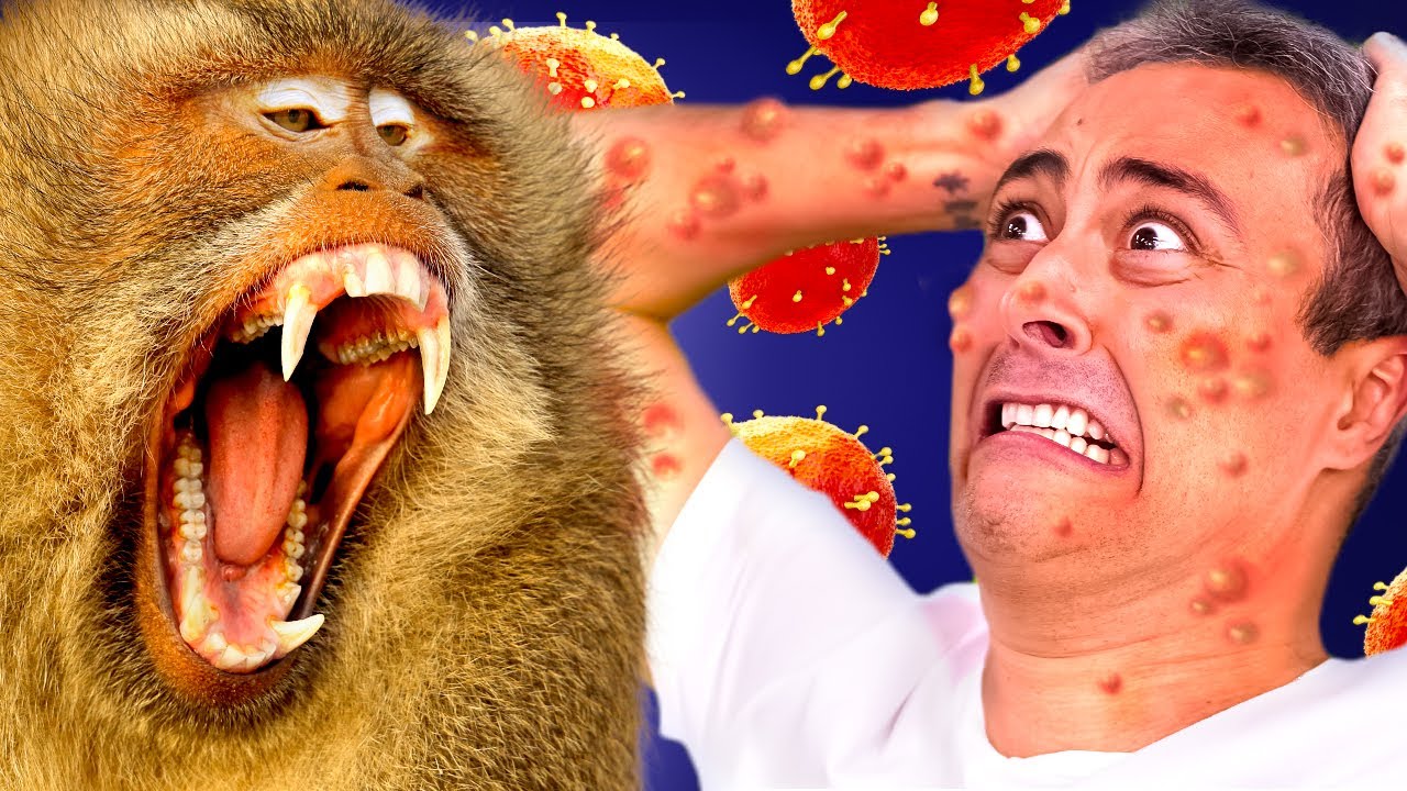 A VARÍOLA DOS MACACOS chega ao Brasil!