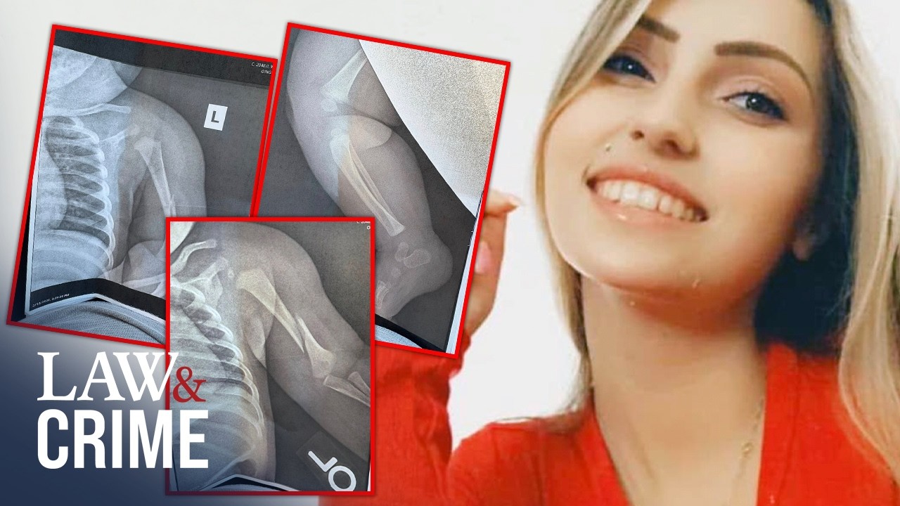 Babysitter Bestie Breaks Baby’s Bones: Police