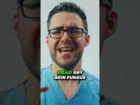 Raynaud s Syndrome When Your Toes Hands or Feet Turn Red or White