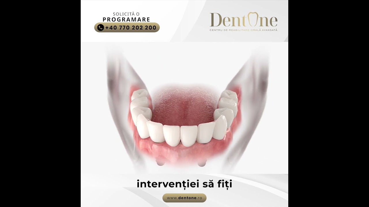 De ce proteza mobilă nu este o soluție pe termen lung