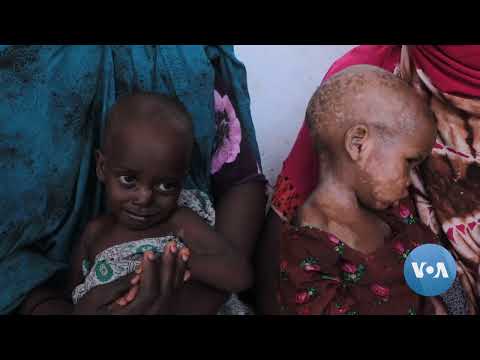 Aid Groups Say Thousands of Somalis at Risk of Starving to Death