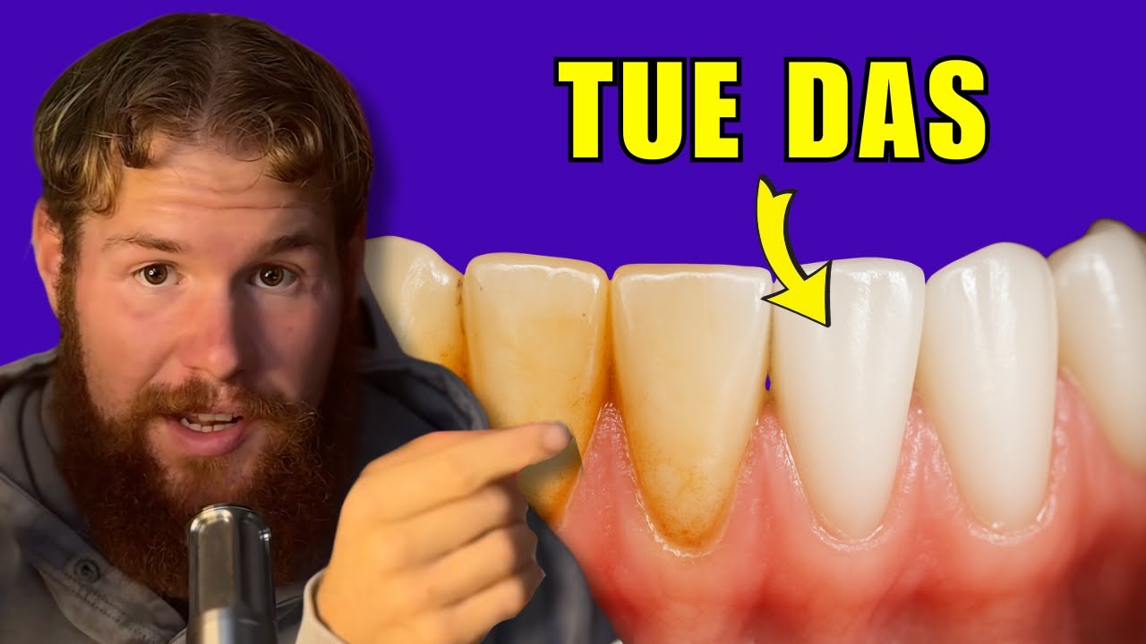 Die #1 STÄRKSTE Lösung für Zahn Plaques (Weißzahn Methode)