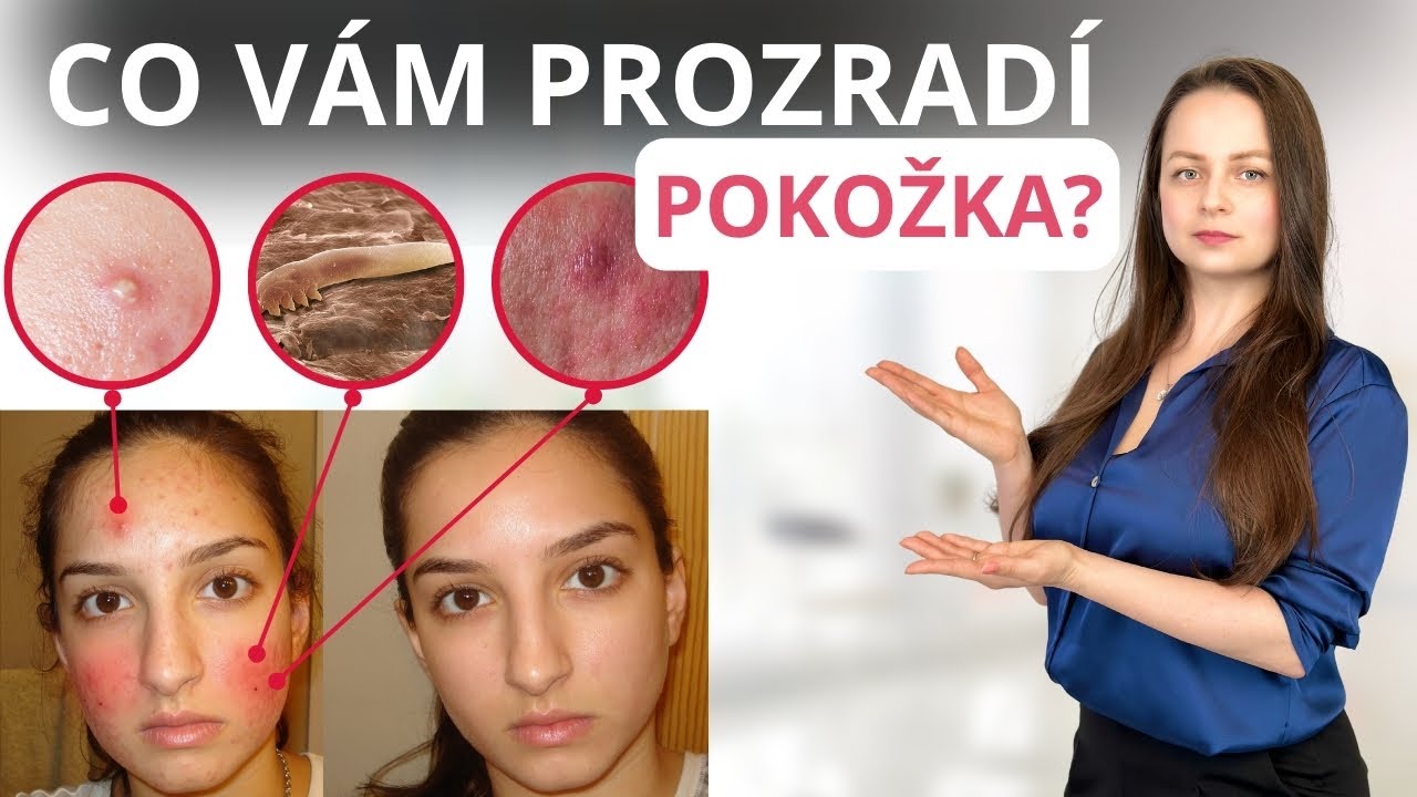 POKOŽKA jako zrcadlo zdraví: vliv nemocí vnitřních orgánů na AKNÉ, EKZÉMY, vyrážky a DEMODEKÓZU