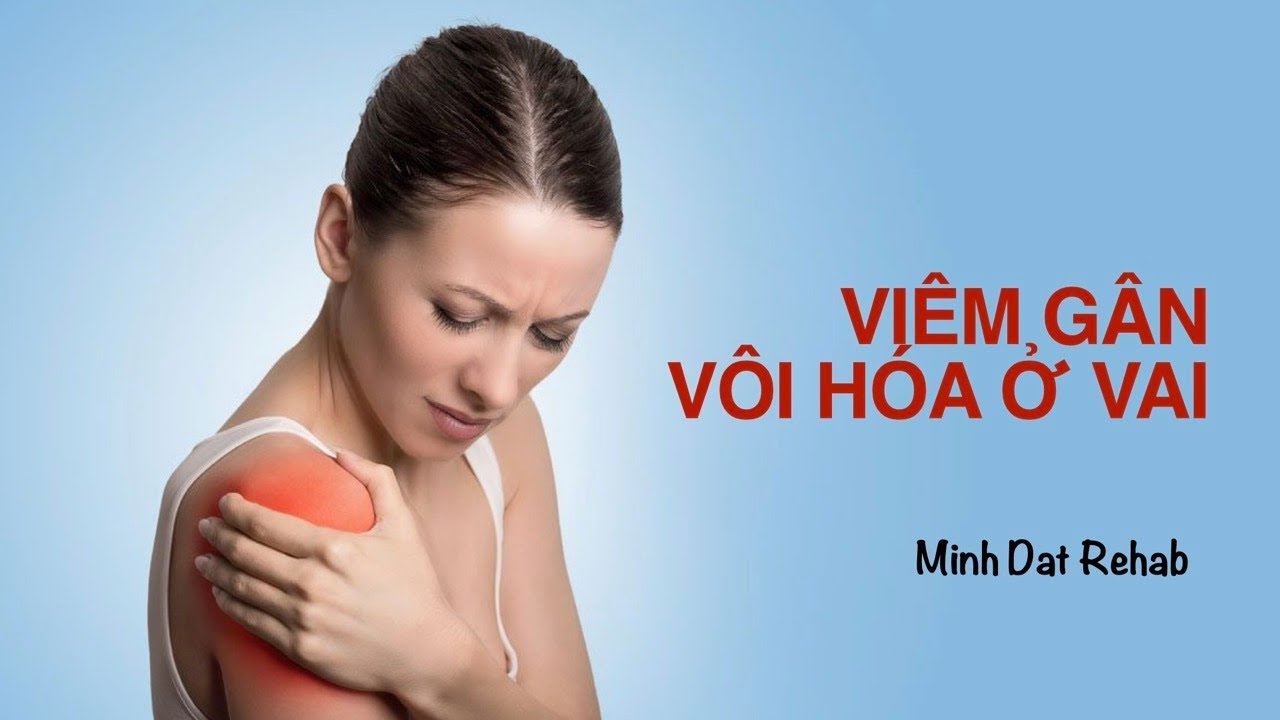 Viêm Gân Vôi Hoá Ở Vai