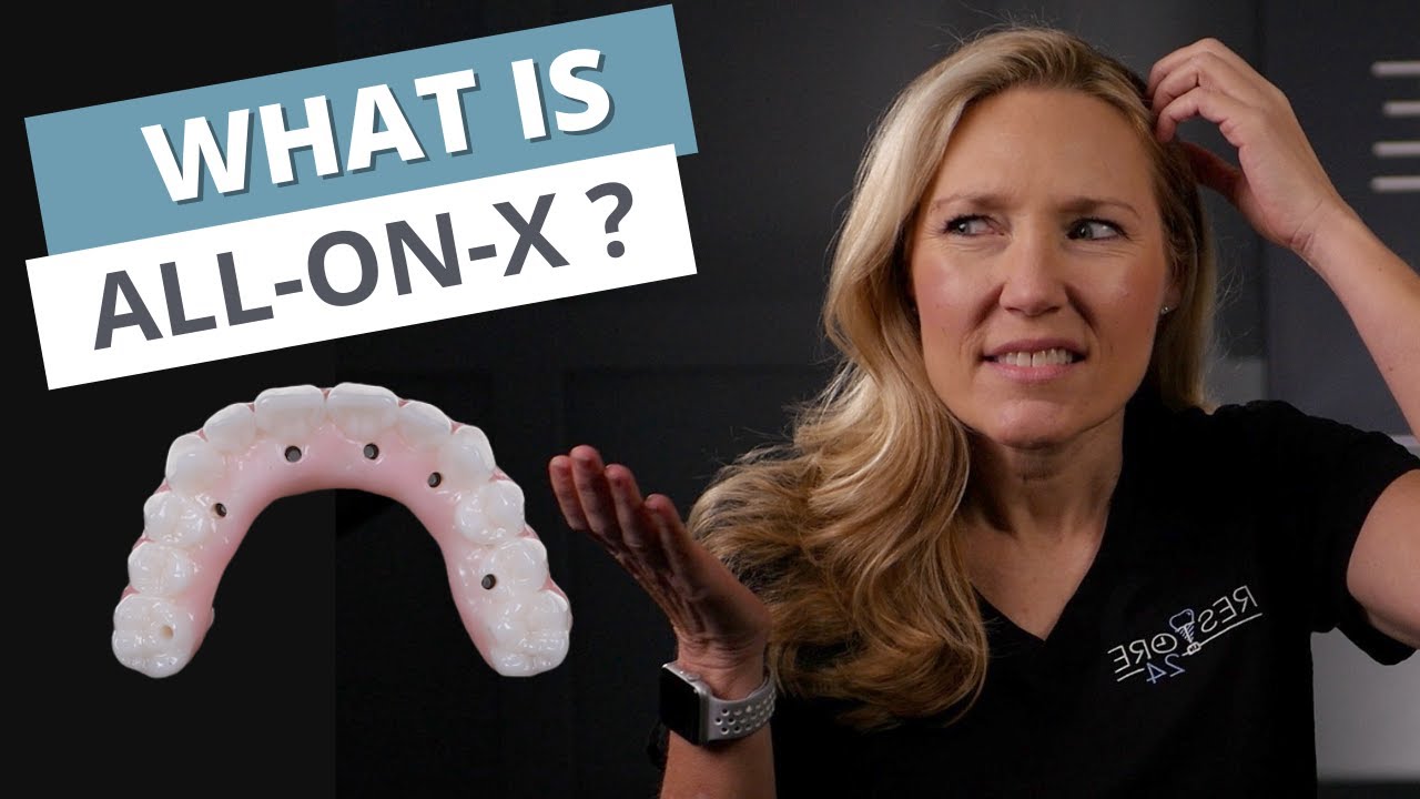 The ALL ON X Dental Implant Procedure | What is It?