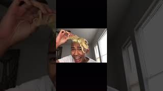 Guy&#39;s Hair Falls out After Bleaching #shorts