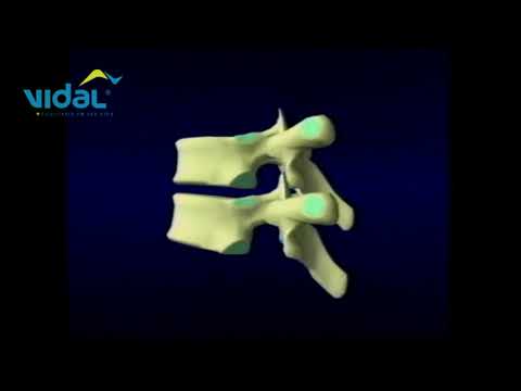 Rotação Anterior / Posterior - Vista Lateral - Vidal