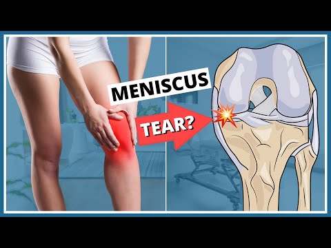 How to check for a meniscus tear? 3 Tests specialists use.
