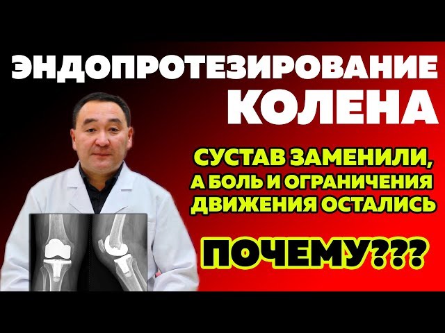 Онемение Колена После Эндопротезирования