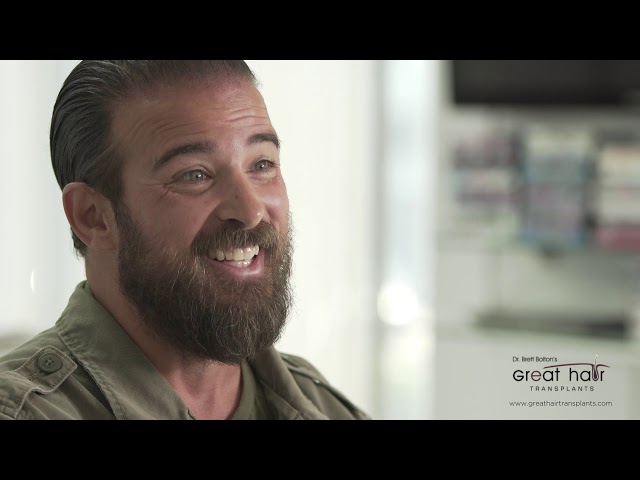 Dr. Brett Bolton Patient Aldo MaxHarvest&trade; Procedure





