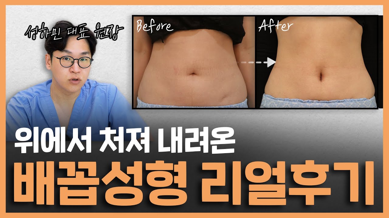 처진 배꼽 체형 개선