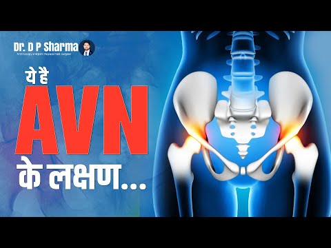 Symptoms of Hip AVN? Hip Pain & Avascular Necrosis Treatment In Delhi-NCR - Dr DP Sharma