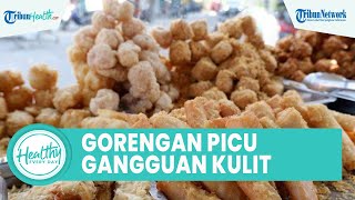 Bahaya Banyak Konsumsi Gorengan Bisa Memicu Gangguan Kulit seperti Komedo, Ini Kata dr. Lusiyanti