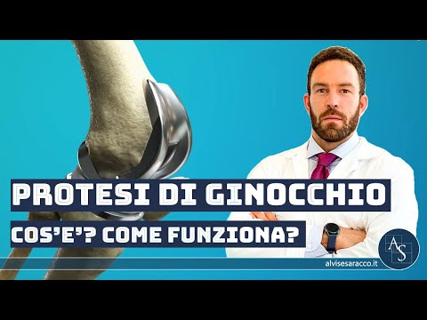 Anteprima video