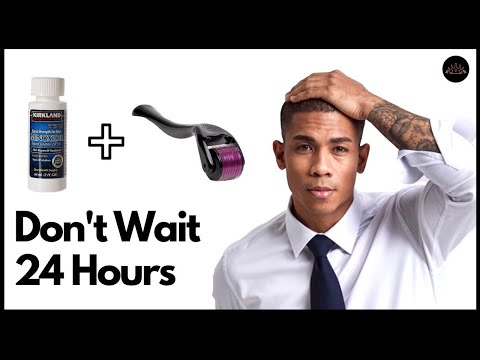 YouTube video about: How long after derma rolling can I use minoxidil?